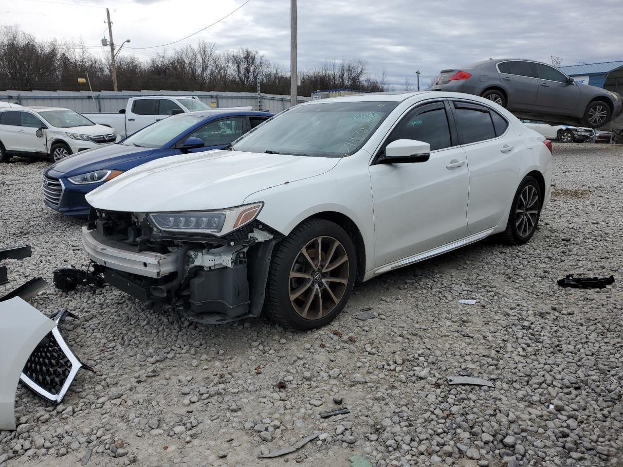 Acura Tlx tech (2018)