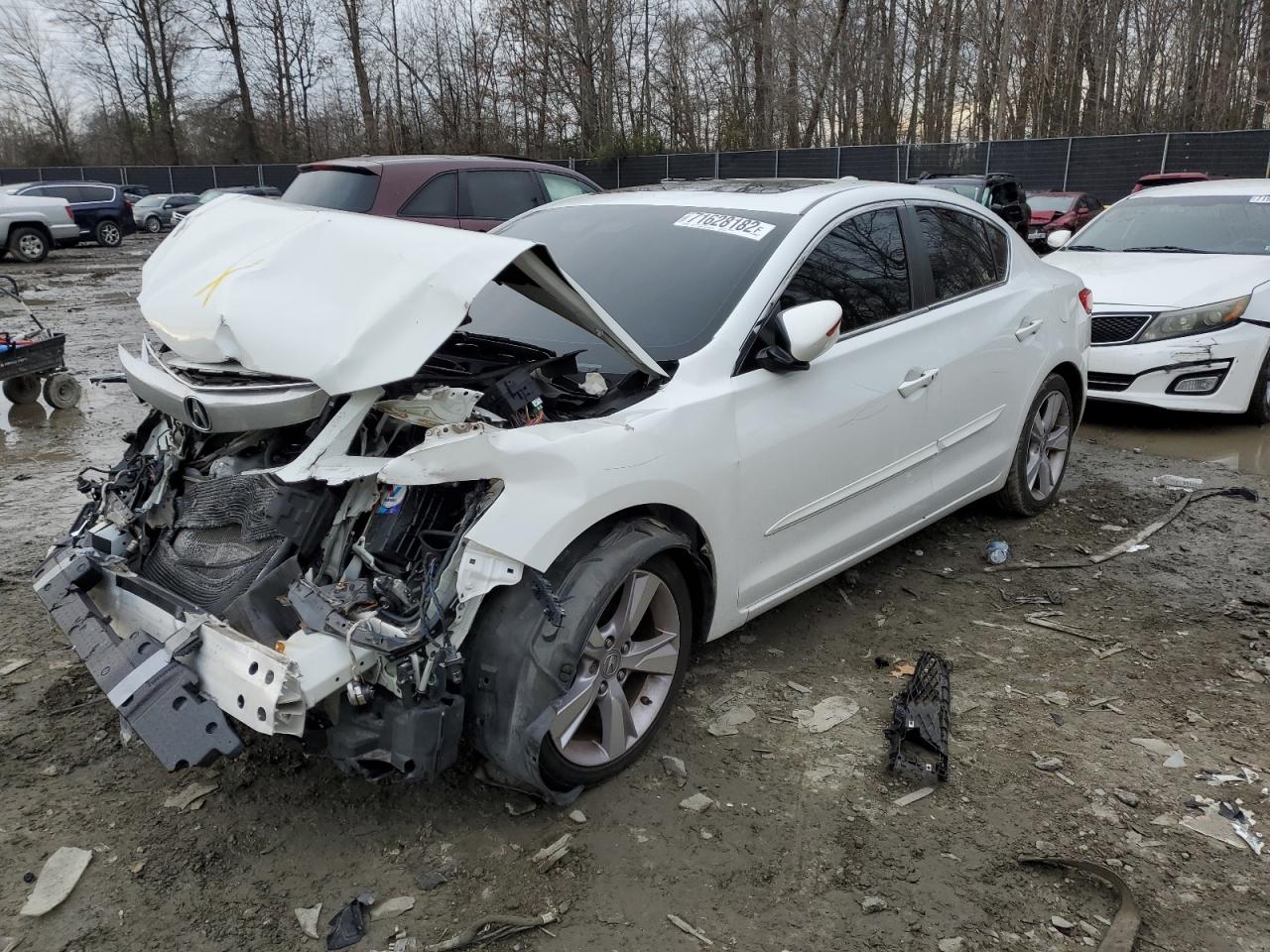 Acura Ilx 20 pre (2015)