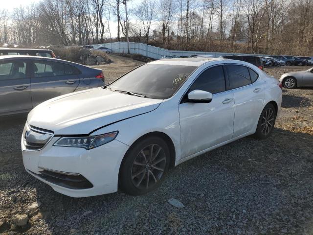 Acura Tlx tech (2015)