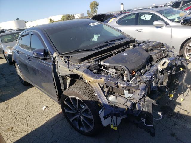 Acura Tlx advanc (2017)