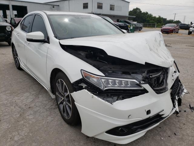 Acura Tlx advanc (2017)