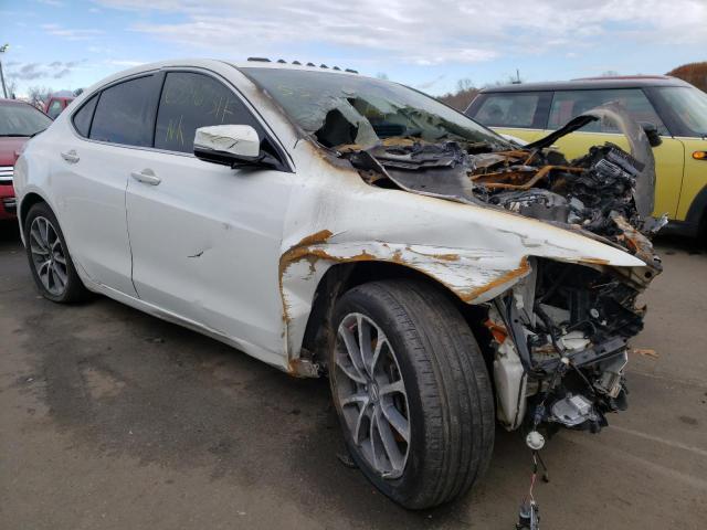 Acura Tlx advanc (2015)