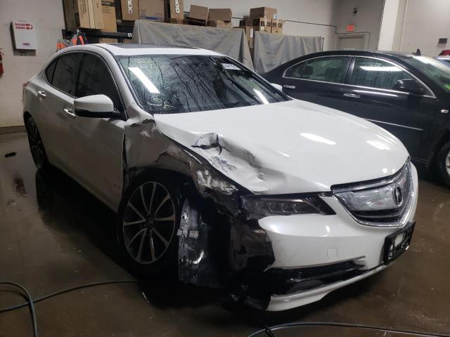 Acura Tlx tech (2015)