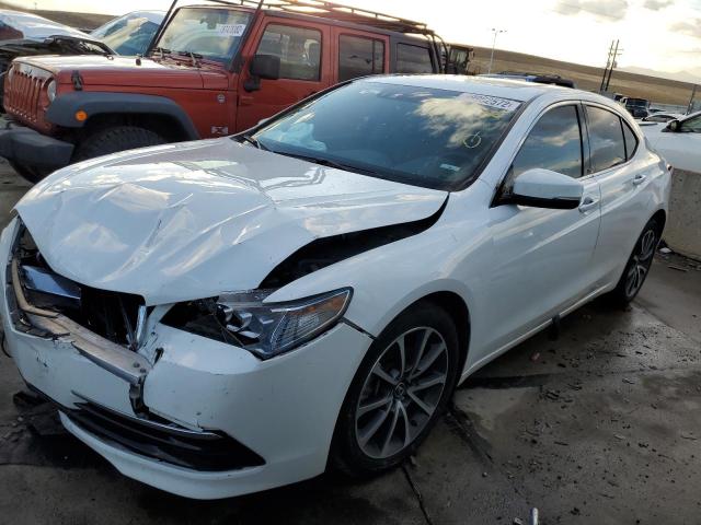 Acura Tlx tech (2017)